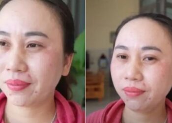 Тази жена твърди, че не спала в продължение на 11 години