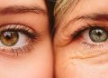 Дерматолог каза, как да се справим с бръчките под очите