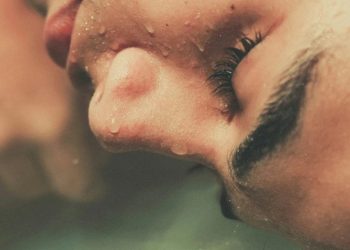 Как да се отървете от черните точки по лицето завинаги: полезни трикове